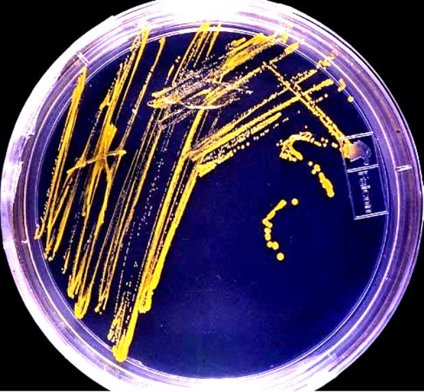 O bakteriach w Śląskiej Kawiarni Naukowej