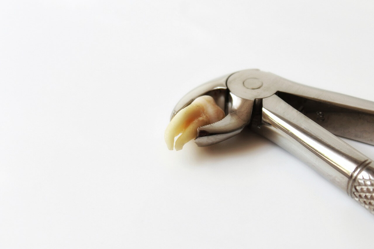 Dlaczego zęby mądrości pojawiają się tak późno?