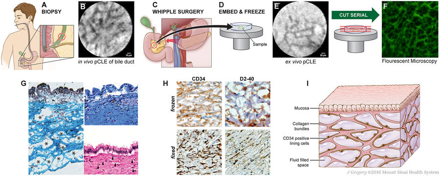 Interstitium – nowo odkryty organ w ludzkim ciele