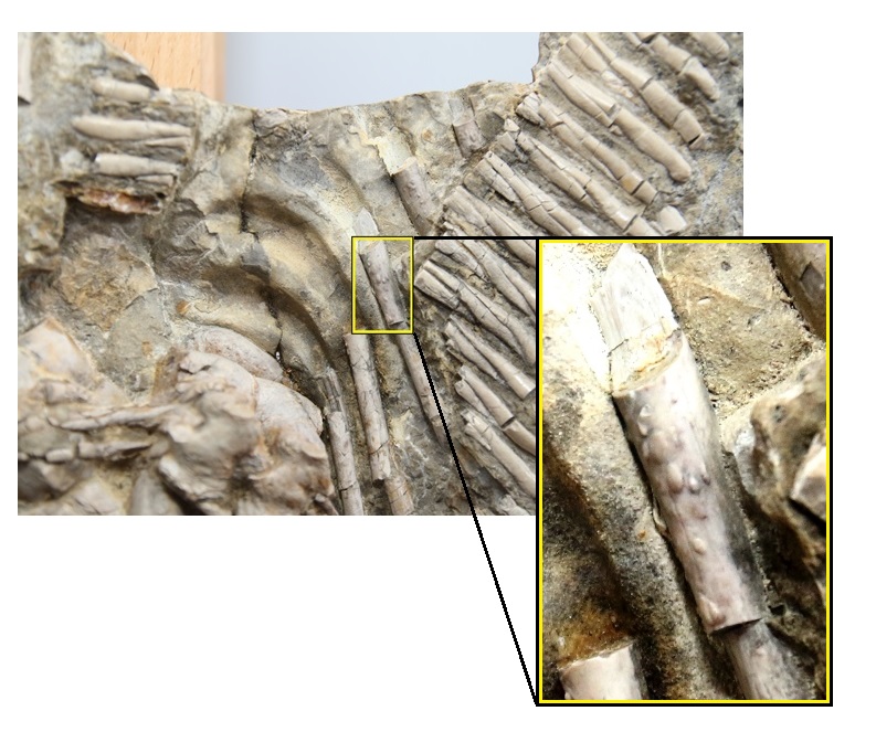 Naukowcy odkryli najstarsze ślady gruźlicy